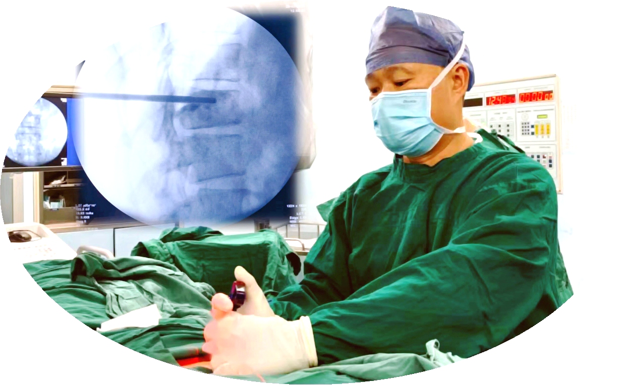 椎体成形术：治疗椎体压缩性骨折的有效选择